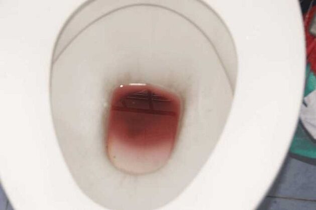 spot in men when they are aroused